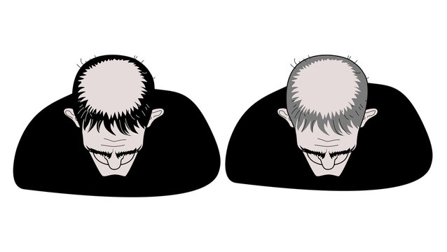 Two men in black clothes top view. Tonsura of a Catholic monk. Bald head and baldness. Vector humorous illustration.