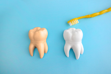 Dental care flat lay with teeth models and teethbrush  on blue background. Dentist day concept.