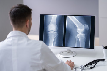 Doctor Examining Knee X-ray