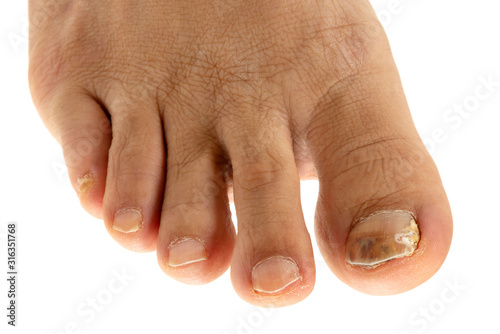 爪水虫 Wall Mural Wallpaper Murals Wallsheaven Caito