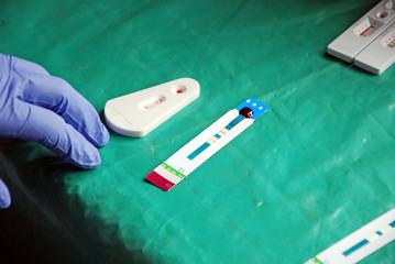 Laboratory analysis of the AIDS virus in Pomerini Village in Tanzania - Africa