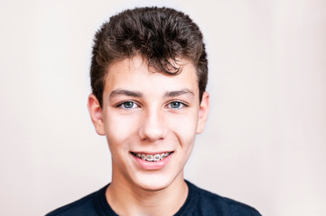 Beautiful portrait of a teenage boy on a light background. The guy has braces on his teeth and he smiles sincerely © Мар'ян Філь