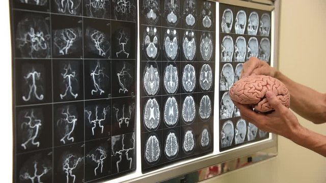 Doctor demonstrating brain model anatomy and brain MRI in operating room