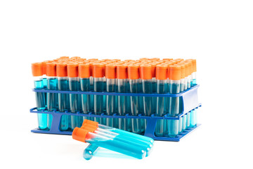 Test tubes with chemical samples