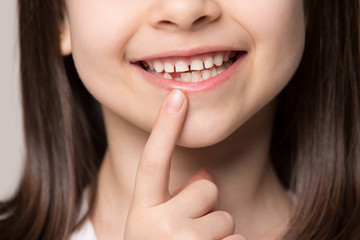 Close up little preschool girl showing growing first permanent molar.