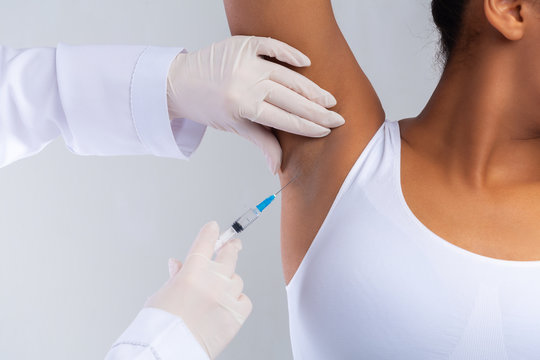 Doctor makes intramuscular injections of botulinum toxin in underarm area