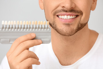 Man with teeth color samples on light background, closeup