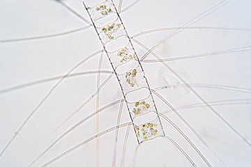 Chaetoceros is marine planktonic diatoms under microscope view.