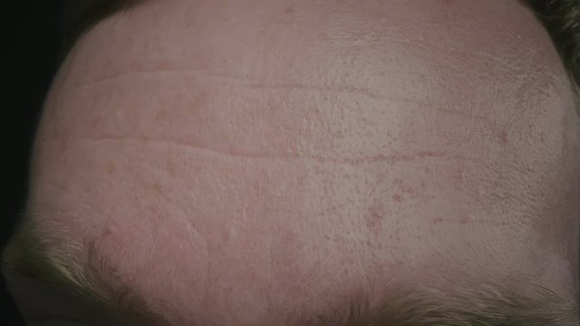Photo of wrinkles on humans forehead, macro shooting