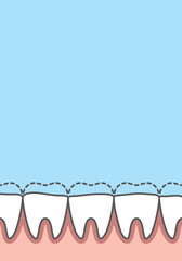 Blank banner attrition (Bruxism) teeth illustration vector on blue background. Dental concept.