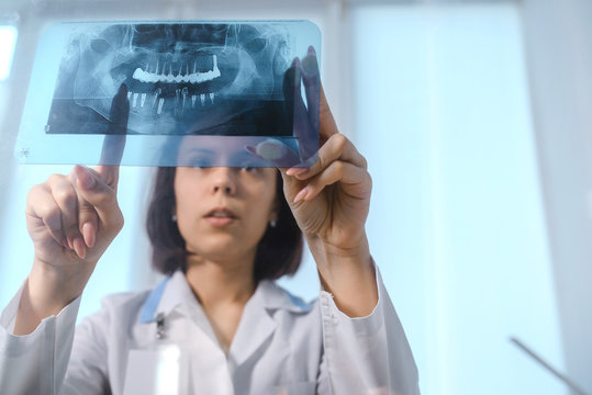 Close up picture of young woman doctor dentist who analysis dental x ray orthopantomogram. Dental panoramic radiography