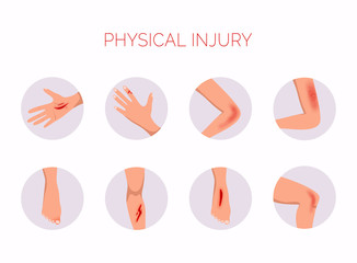 Human body physical injury round flat set. Open cut wounds and elbow bruise.