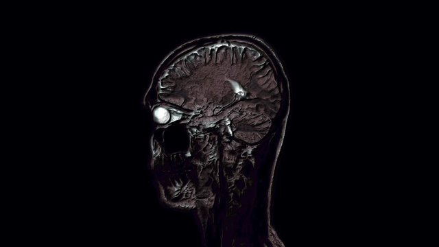 Voluminous color MRI scans of the brain and head to detect tumors. Diagnostic medical tool