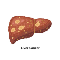Liver cancer icon isolated on white background. Liver disease concept illustration in flat design.