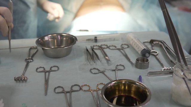 work of surgeons with assistants in the surgical room a complete facelift with an endoscope