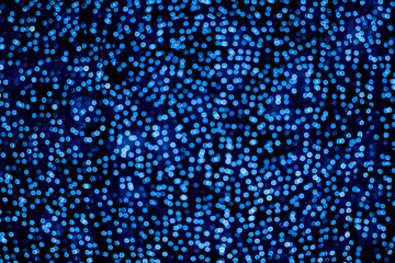 Many blurred lights.