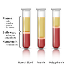 Blood analysis infografics