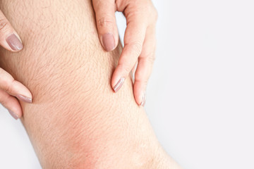 closeup woman with hairy, unshaven leg  