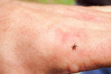 Scale tick, hard mite of family Ixodidae on human hand. It carrier of pathogens that can cause human disease.