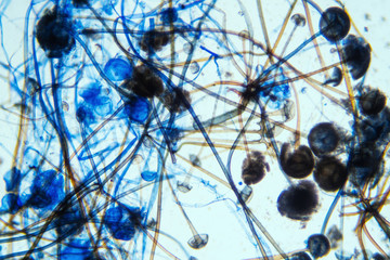 Rhizopus bread mold under the microscope.