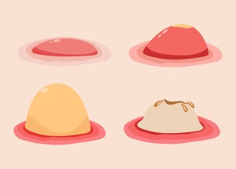 Different stages of acne.