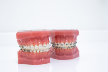 Close up tooth model / mock tooth in dental clinic. Mock tooth or tooth model is used by dentist to demonstrate how human teeth & jaw works. Dental care and dentist 's equipment concept. Copy space.