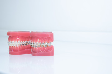 Close up tooth model / mock tooth in dental clinic. Mock tooth or tooth model is used by dentist to demonstrate how human teeth & jaw works. Dental care and dentist 's equipment concept. Copy space.