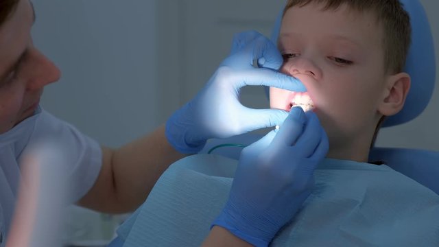 Dentist making fluoridation of child boy teeth after cleaning for protection. Doctor hygienist applying fluoride to teen teeth with brush in dentistry. Covering teeth with fluoride gel. Cure concept.