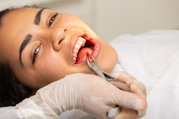 Young woman being seen in a dentist's office. Concept of toothache, wisdom tooth extraction, anesthesia, problems with caries or gums. Oral health care. Dentist day.