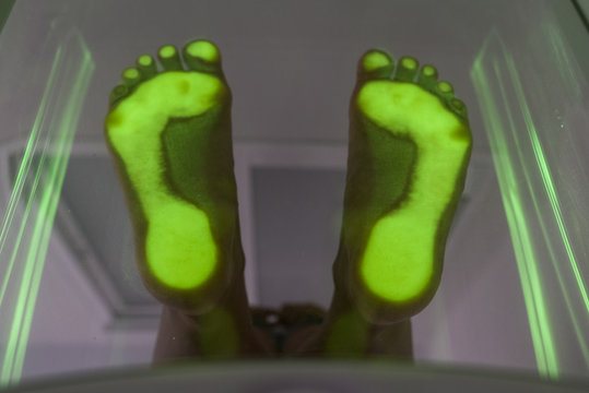 Foot step scanning of patient