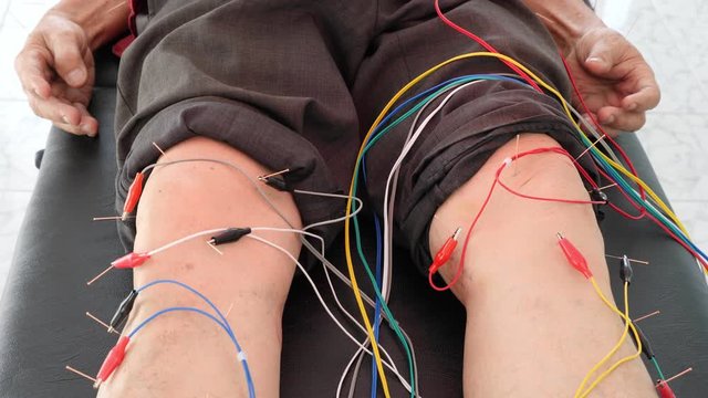 Asian man receiving knee and leg acupuncture with electrical stimulator at clinic.Alternative medicine concept.