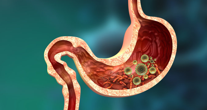 Cross section of human stomach with viruses and bacteria. 3d illustration.