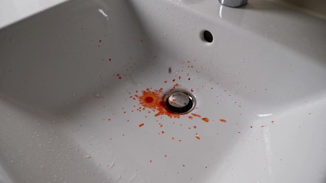 Slow motion shot of the fresh blood dripping into the bathroom sink. Human health affected.
