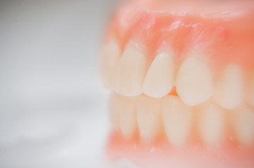 Set of dentures, close up teeth. Diagnosis and copayment. Selective focus