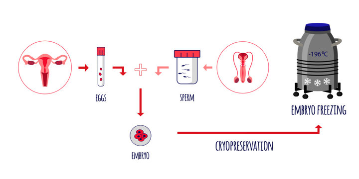 Cryo Preservation Of Embryo. Egg And Sperm Donation. Sperm Banking. Embryo Freezing. Vector Illustration.