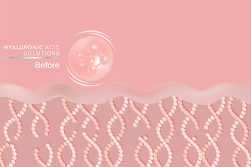 Hyaluronic acid skin solutions ad, pink collagen serum drop with cosmetic advertising background ready to use, illustration vector.