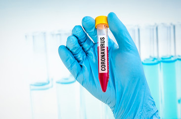 Test-tube with positive blood test on CORONAVIRUS