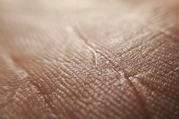 Skin diseases concept. macro skin of human hand.Medicine and dermatology concept. Details of human skin background.
