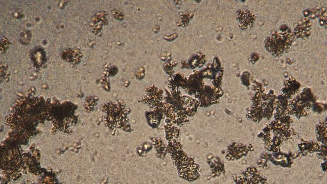 Microscopy of protozoa ciliate and small microorganisms in the water sample. Magnification 300x infusoria under microscope in active movement and feed process.