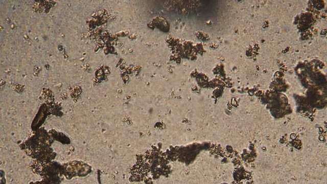 Microscopy of protozoa ciliate and small microorganisms in the water sample. Magnification 300x infusoria under microscope in active movement and feed process.