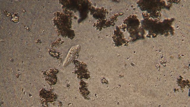 Microscopy of Amoeba limax in the water (pond) sample. Magnification 300x microorganism in active movement.