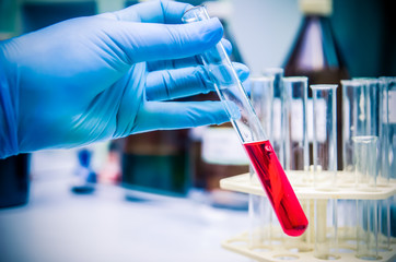 woman's hand in blue gloves holds a glass test tube (Proberochr) with red (purple) water (blood,...