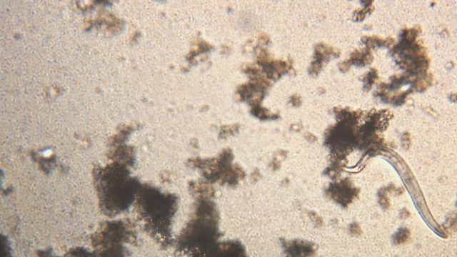 Microscopy of parasite worm nematode (Strongyloides stercoralis). Movement of active parasite infection form in magnification 150x.