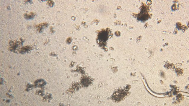 Microscopy of parasite worm nematode (Strongyloides stercoralis). Movement of active parasite infection form in magnification 150x.