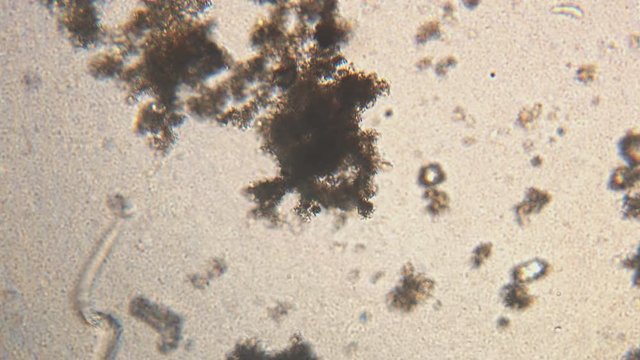 Microscopy of parasite worm nematode (Strongyloides stercoralis). Movement of active parasite infection form in magnification 150x.