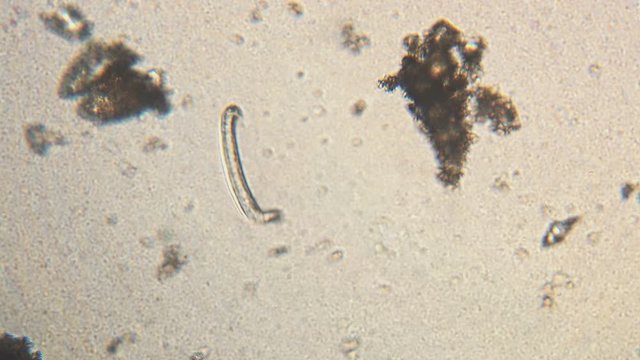 Microscopy of parasite worm nematode (Strongyloides stercoralis). Movement of active parasite infection form in magnification 150x.