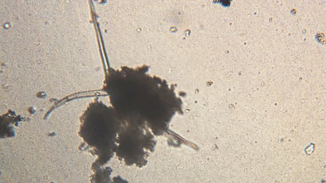 Microscopy of parasite worm nematode (Strongyloides stercoralis). Movement of active parasite infection form in magnification 150x.