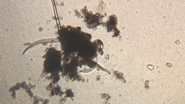Microscopy of parasite worm nematode (Strongyloides stercoralis). Movement of active parasite infection form in magnification 150x.
