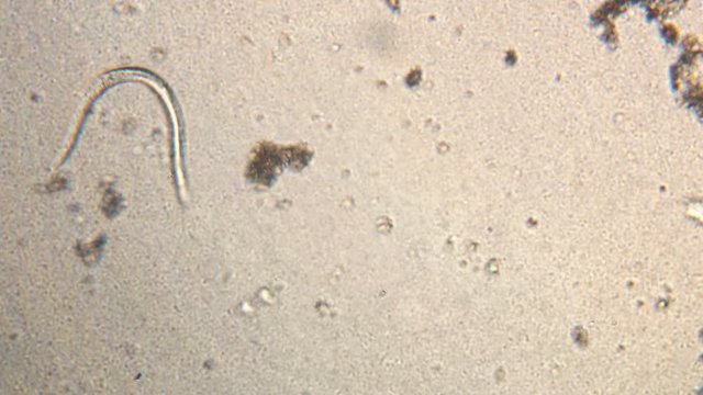 Microscopy of parasite worm nematode (Strongyloides stercoralis). Movement of active parasite infection form in magnification 150x.