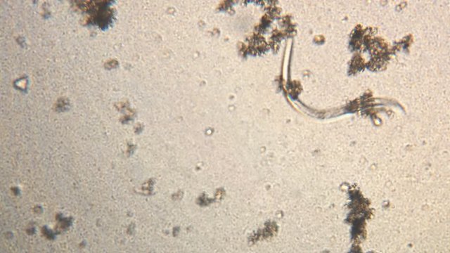Microscopy of parasite worm nematode (Strongyloides stercoralis). Movement of active parasite infection form in magnification 150x.